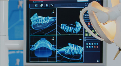 잇몸뼈가 심하게 녹은 환자 임플..